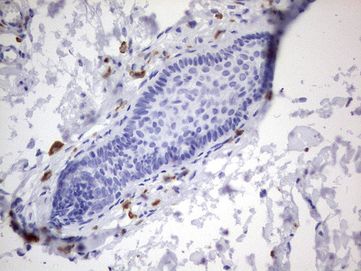 PMEL Antibody in Immunohistochemistry (Paraffin) (IHC (P))