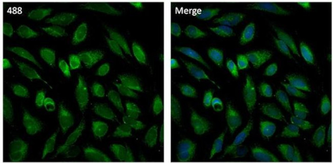 PMP70 Antibody in Immunocytochemistry (ICC/IF)