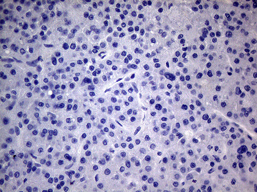 PMP22 Antibody in Immunohistochemistry (Paraffin) (IHC (P))