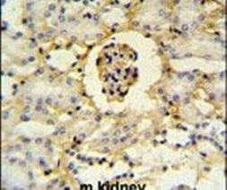 PMPCB Antibody in Immunohistochemistry (IHC)