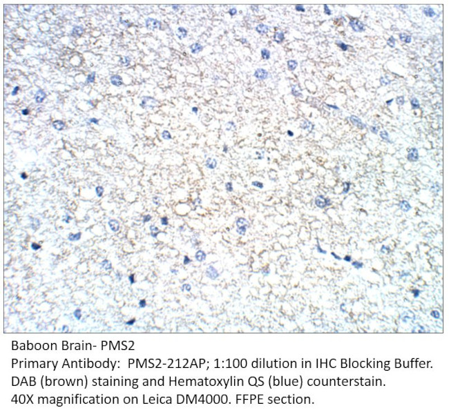 PMS2 Antibody in Immunohistochemistry (IHC)