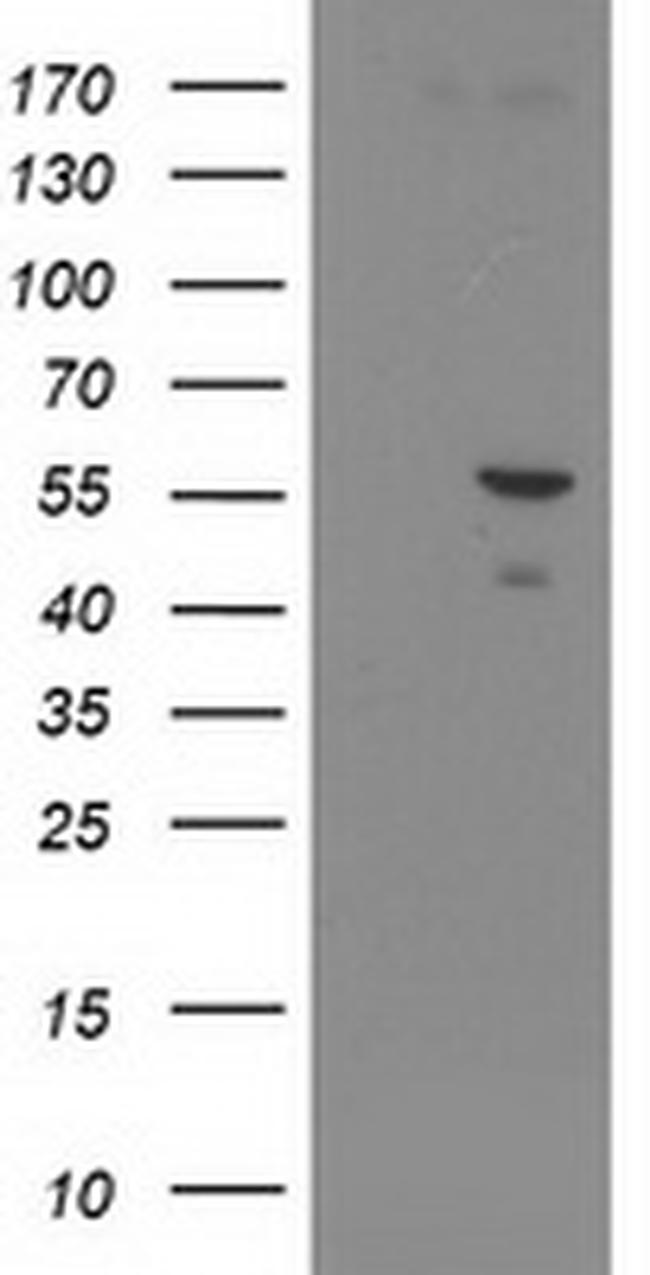 PNMA3 Antibody in Western Blot (WB)