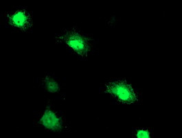 PNMT Antibody in Immunocytochemistry (ICC/IF)