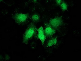 PNMT Antibody in Immunocytochemistry (ICC/IF)
