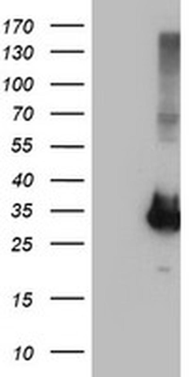 PNMT Antibody in Western Blot (WB)