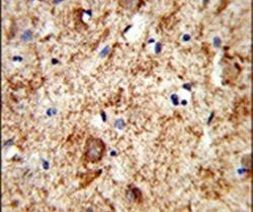 PNOC Antibody in Immunohistochemistry (IHC)