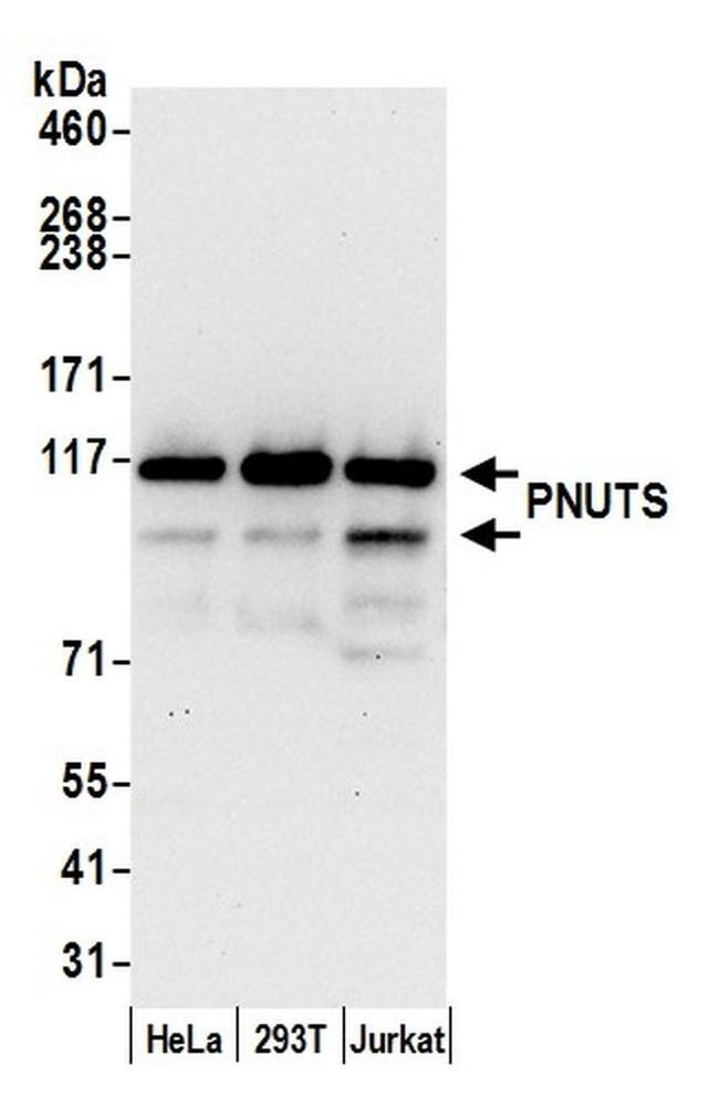 PNUTS Antibody in Western Blot (WB)