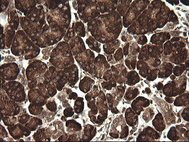 POGK Antibody in Immunohistochemistry (Paraffin) (IHC (P))