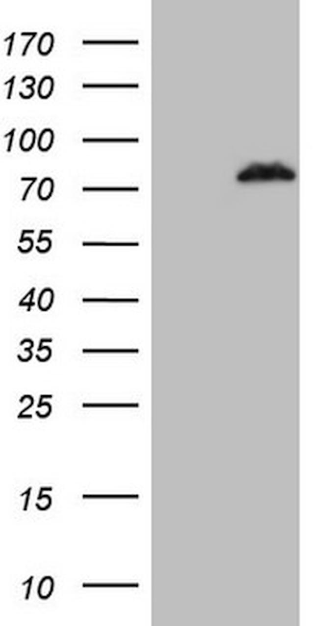 POLA2 Antibody in Western Blot (WB)