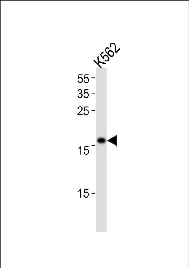 POLE3 Antibody in Western Blot (WB)