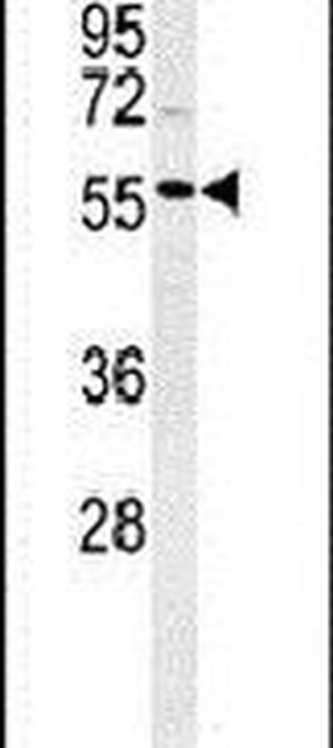POLL Antibody in Western Blot (WB)