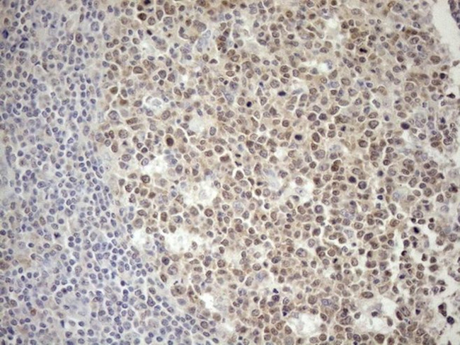 POU2AF1 Antibody in Immunohistochemistry (Paraffin) (IHC (P))