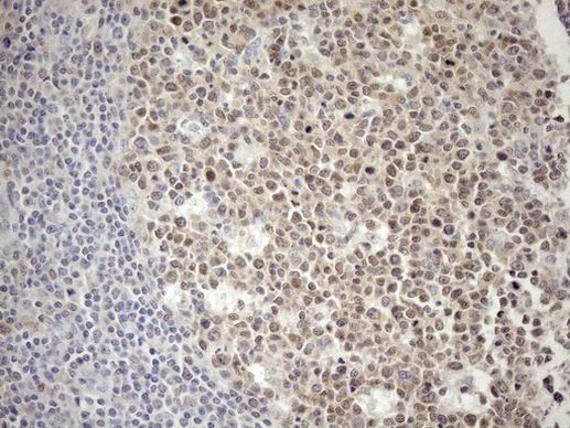 POU2AF1 Antibody in Immunohistochemistry (Paraffin) (IHC (P))