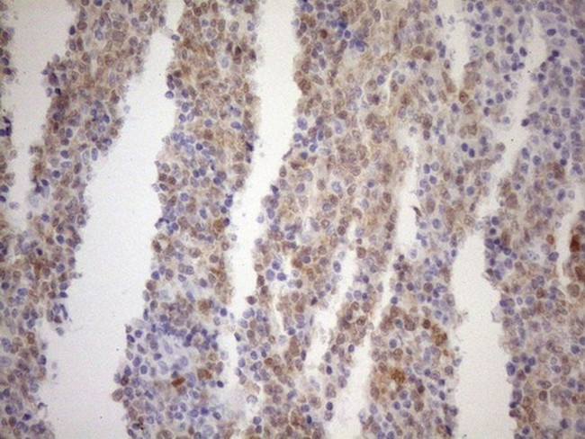 POU2AF1 Antibody in Immunohistochemistry (Paraffin) (IHC (P))