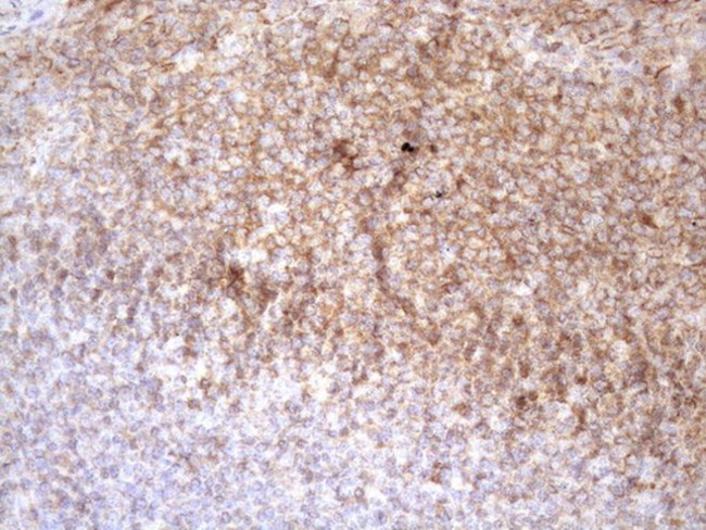POU2AF1 Antibody in Immunohistochemistry (Paraffin) (IHC (P))