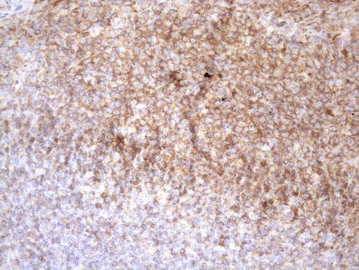 POU2AF1 Antibody in Immunohistochemistry (Paraffin) (IHC (P))