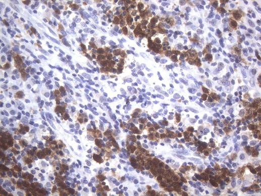 POU2AF1 Antibody in Immunohistochemistry (Paraffin) (IHC (P))