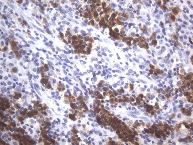 POU2AF1 Antibody in Immunohistochemistry (Paraffin) (IHC (P))
