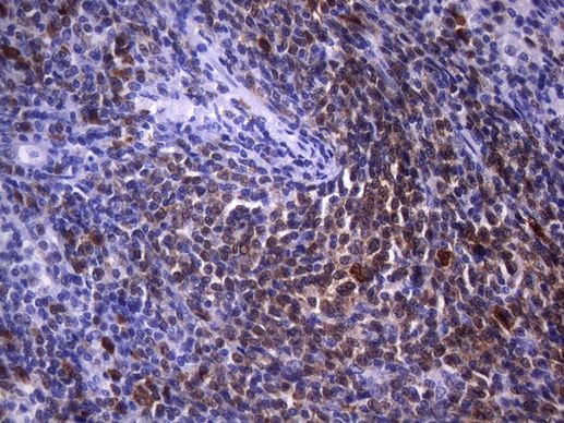 POU2AF1 Antibody in Immunohistochemistry (Paraffin) (IHC (P))