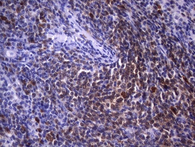 POU2AF1 Antibody in Immunohistochemistry (Paraffin) (IHC (P))