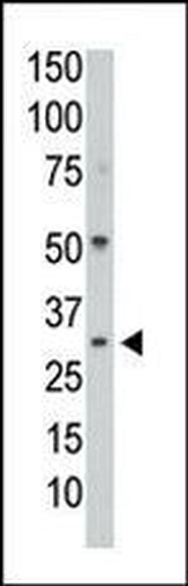 PP1 gamma Antibody in Western Blot (WB)