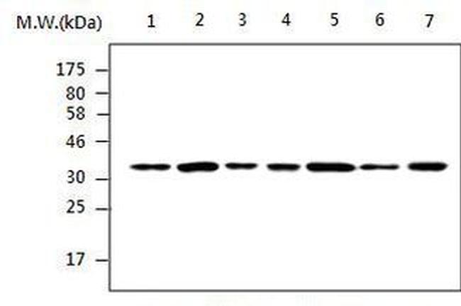 PP1 gamma Antibody in Western Blot (WB)