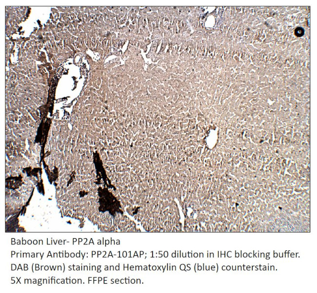 PP2A-alpha Antibody in Immunohistochemistry (IHC)
