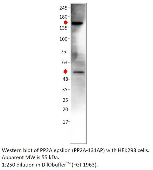 PP2A-epsilon Antibody in Western Blot (WB)