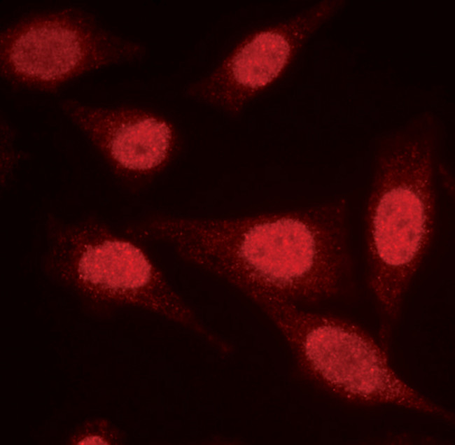 PPP2R1A Antibody in Immunocytochemistry (ICC/IF)