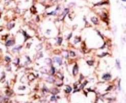 PP5 Antibody in Immunohistochemistry (IHC)
