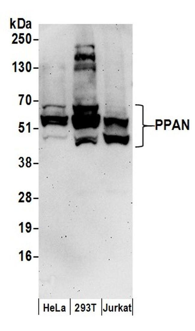 Ppan Pattern PPAN Polyclonal Antibody (A304-598A)