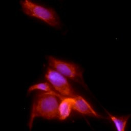 PPAR gamma-2 Antibody in Immunocytochemistry (ICC/IF)