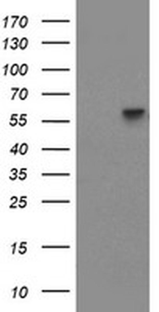 PPAT Antibody in Western Blot (WB)