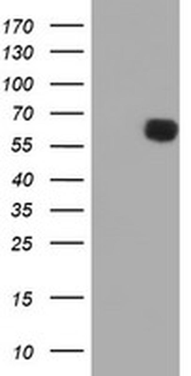 PPAT Antibody in Western Blot (WB)