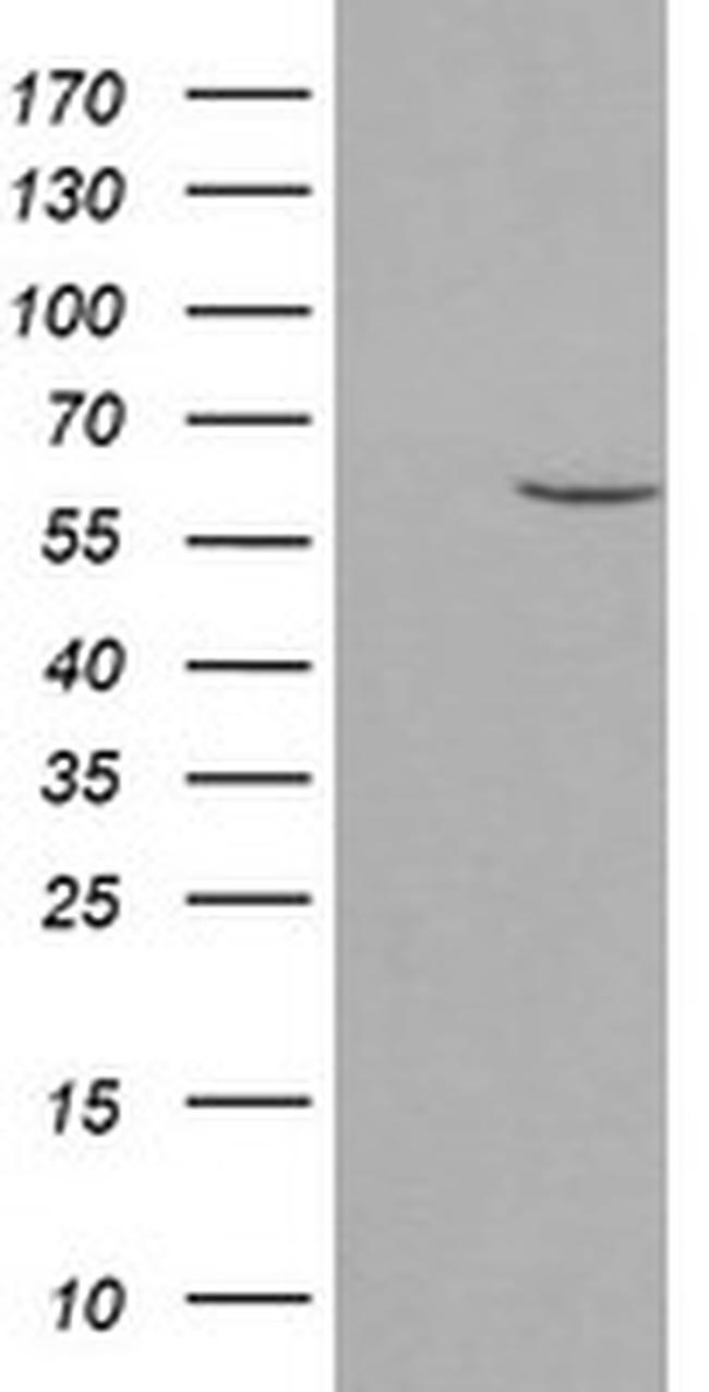 PPAT Antibody in Western Blot (WB)