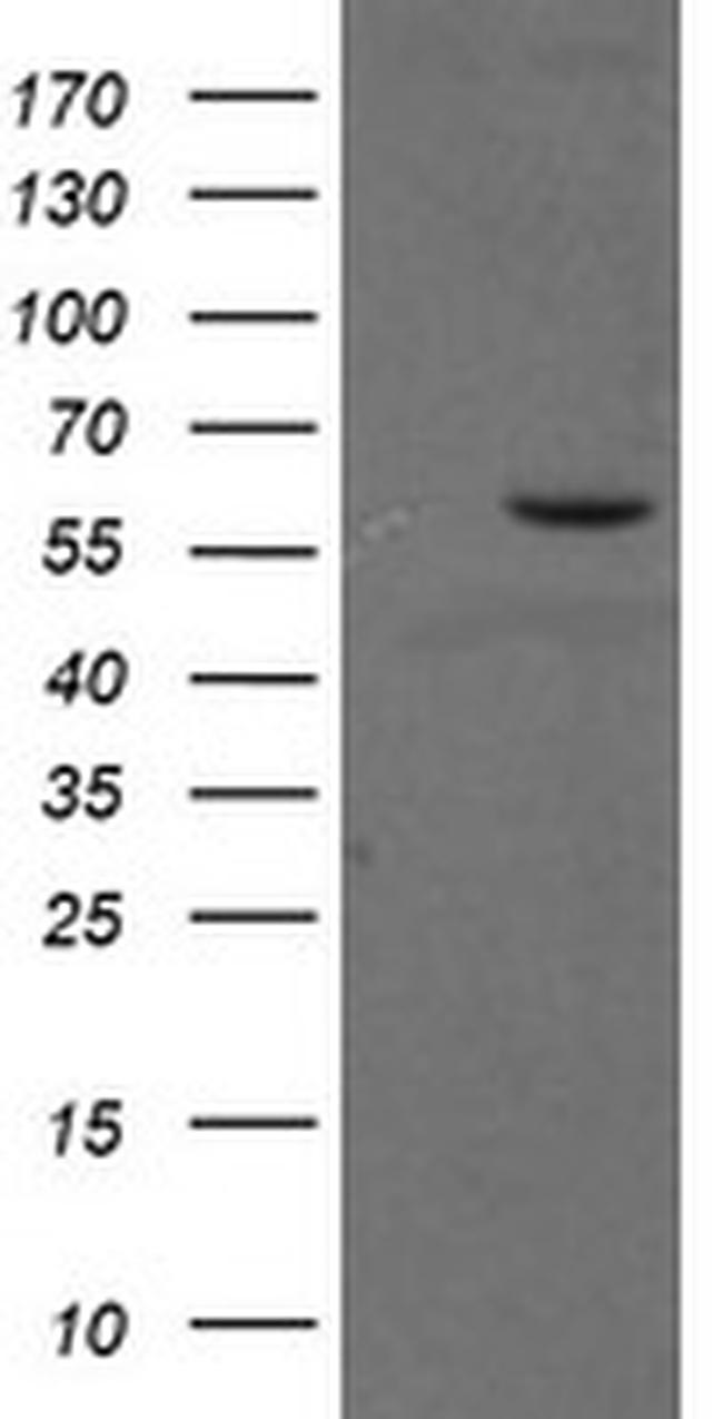 PPAT Antibody in Western Blot (WB)