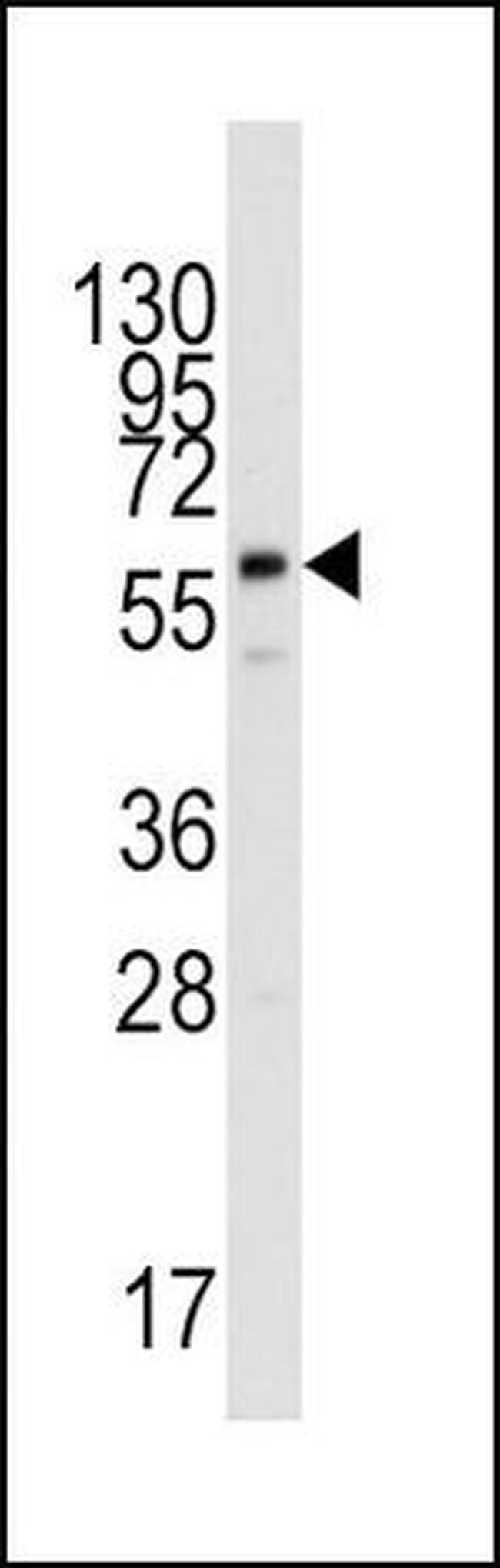 PPAT Antibody in Western Blot (WB)