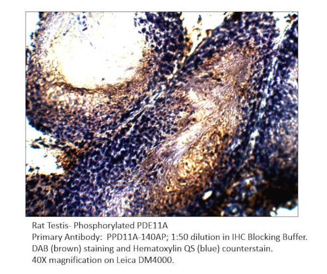 Phospho-PDE11A (Ser117) Antibody in Immunohistochemistry (IHC)