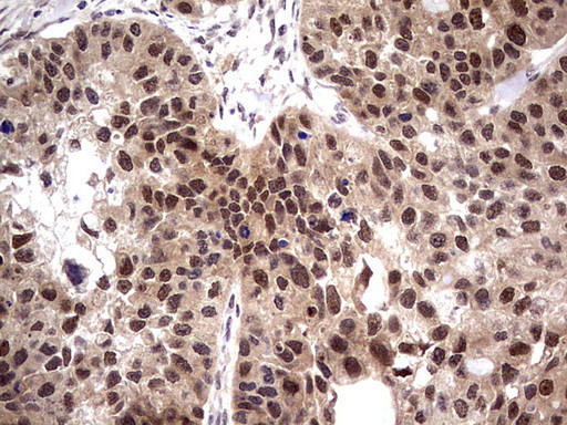 PPIL1 Antibody in Immunohistochemistry (Paraffin) (IHC (P))