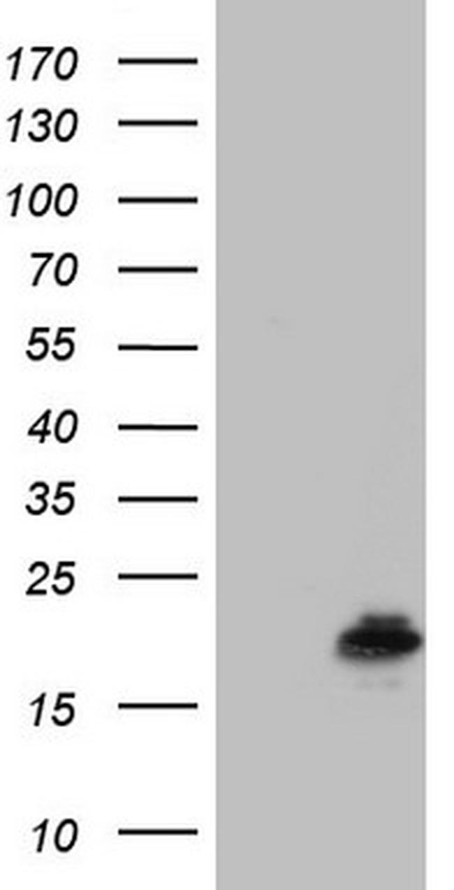 PPIL1 Antibody in Western Blot (WB)