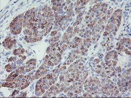 PPIL6 Antibody in Immunohistochemistry (Paraffin) (IHC (P))