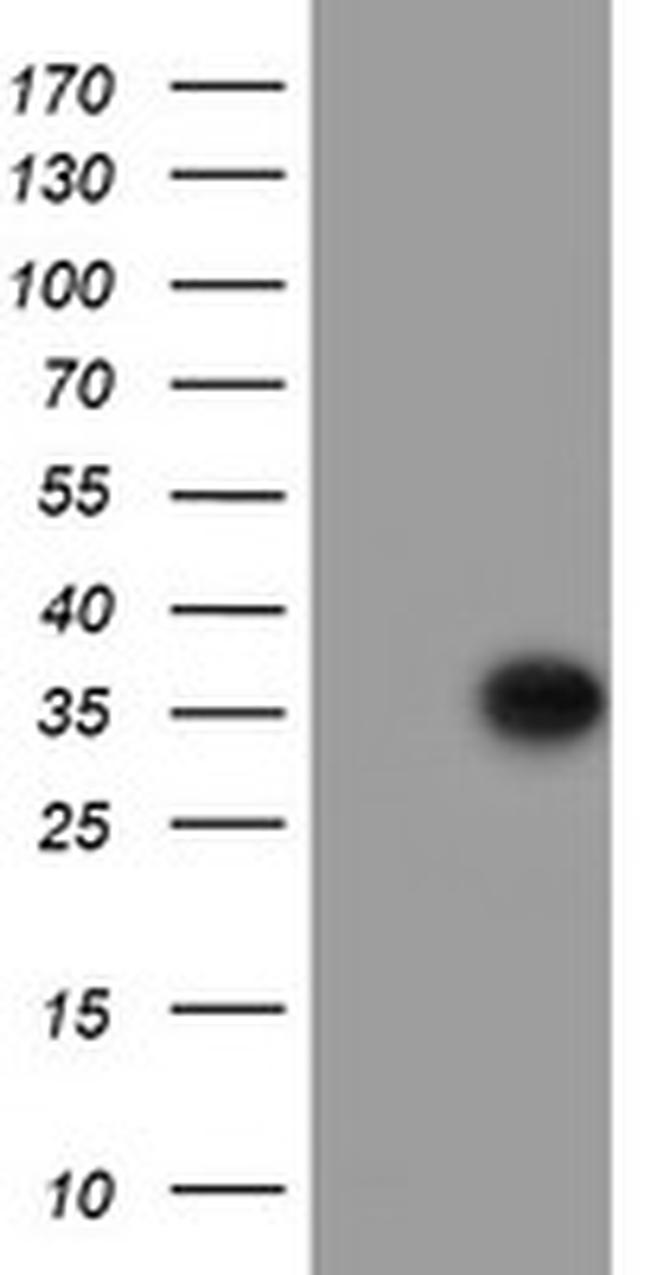 PPIL6 Antibody in Western Blot (WB)