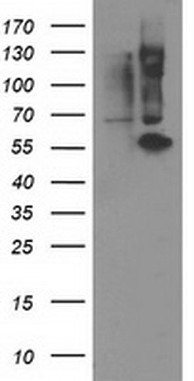 PPM1B Antibody in Western Blot (WB)