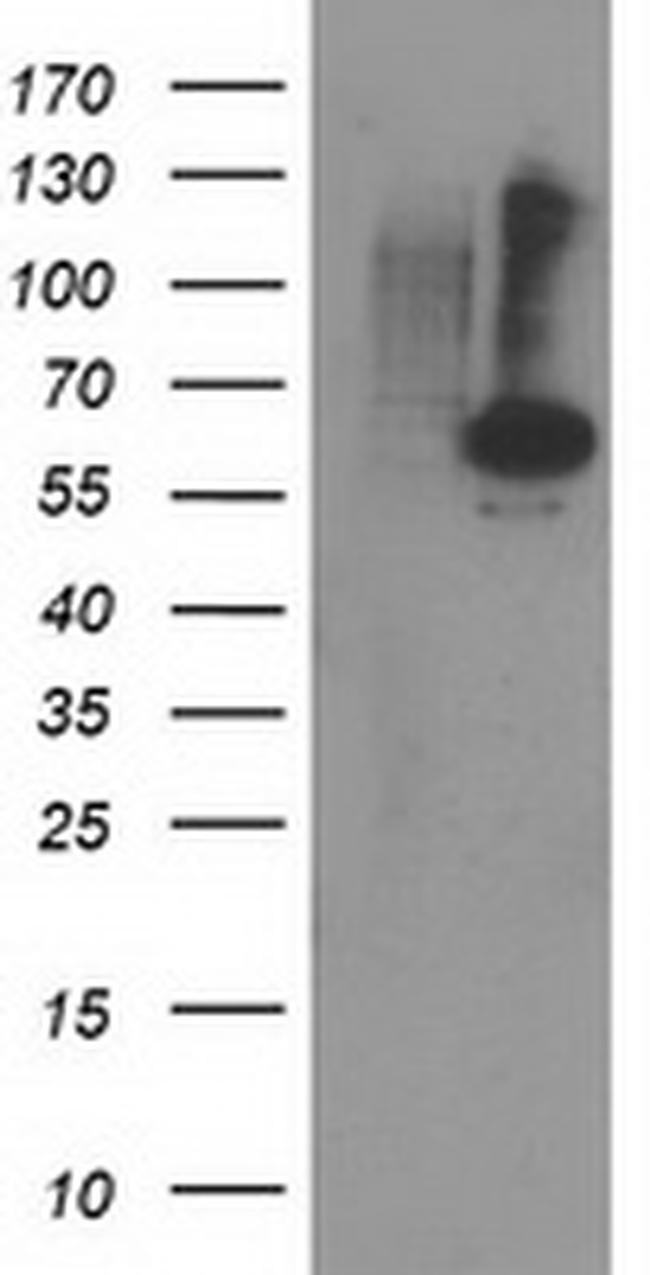 PPM1B Antibody in Western Blot (WB)