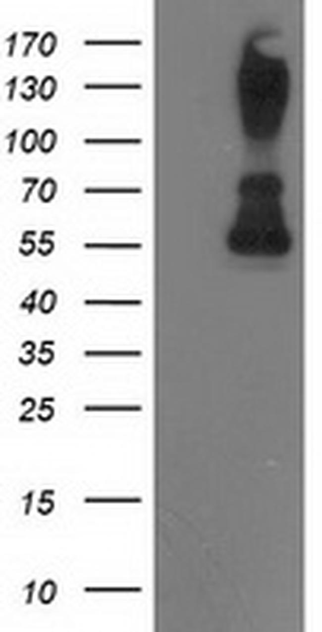 PPM1B Antibody in Western Blot (WB)
