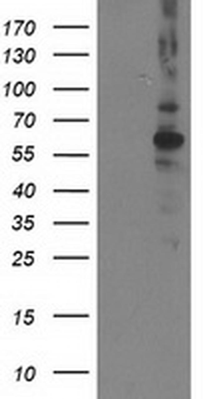 PPM1B Antibody in Western Blot (WB)