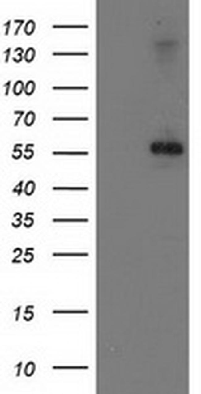 PPM1B Antibody in Western Blot (WB)