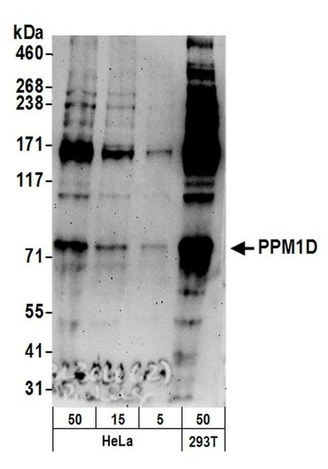 PPM1D Antibody in Western Blot (WB)