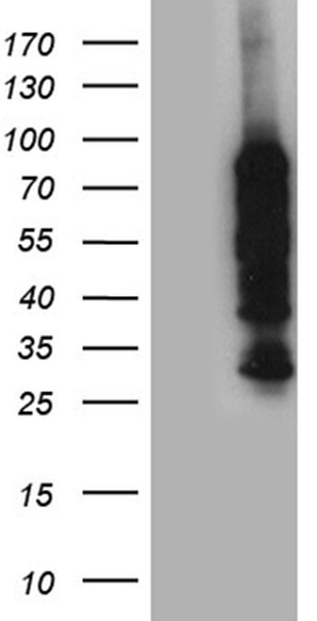 PPM1D Antibody in Western Blot (WB)