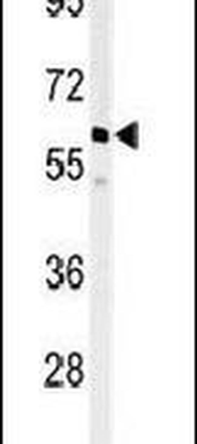 PPM1G Antibody in Western Blot (WB)